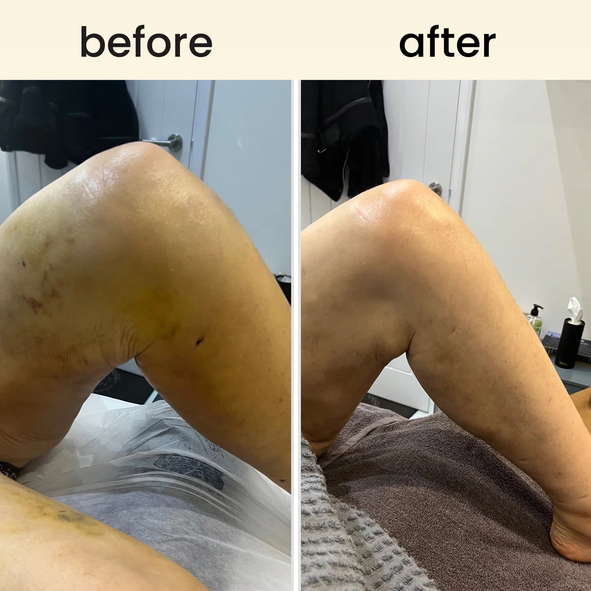 Leg Massage Roller Relaxation And Shaping Muscles