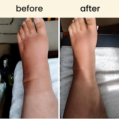 Leg Massage Roller Relaxation And Shaping Muscles