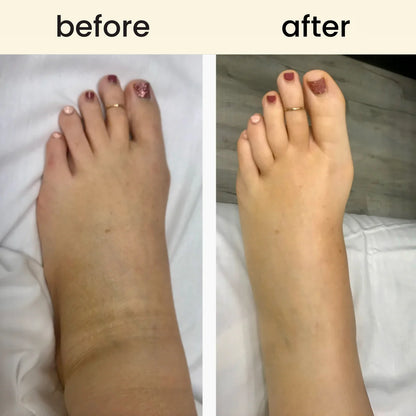 Leg Massage Roller Relaxation And Shaping Muscles